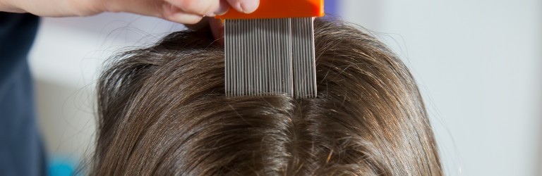 Preventing and Treating Head Lice: A Parent's Guide to Unpleasant Parasites  | Lice