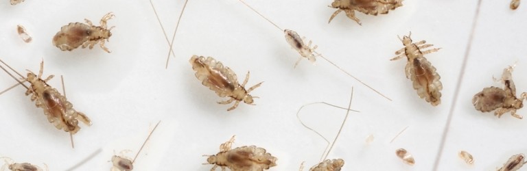 The Life Cycle of Head Lice: From Egg to Adult and Everything In-between |  Lice
